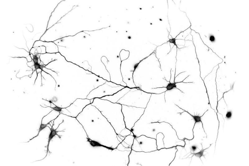 Cultured-Neurons_16cols.jpg